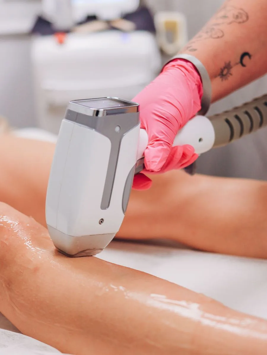Laser hair removal device with a digital display being used on a client's leg coated in cooling gel, an example of the equipment and preparation detail that supports a cost or safety-focused hook